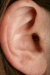 ear-closeup.jpg ear-closeup.jpg