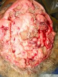 maggots-in-brain.jpg