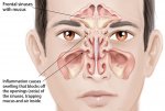 tips-buang-resdung-efektif-dan-berkesan.jpg