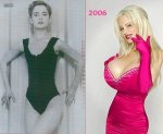 plastic-surgery-23.jpg