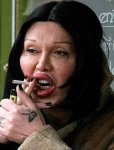 plastic-surgery-24.jpg