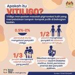 Apakah Itu Vitiligo?