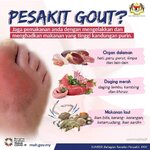Pesakit Gout?