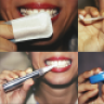 MySmile